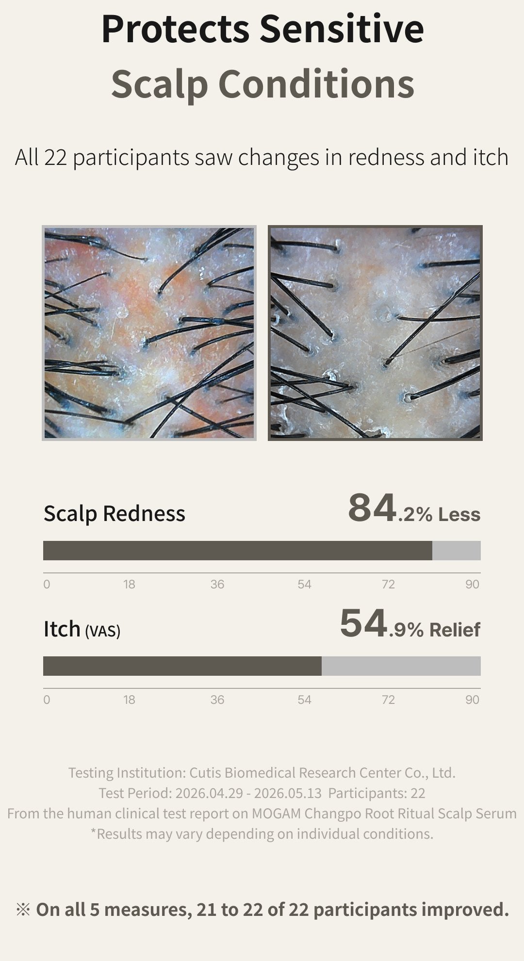 MOGAM Changpo Root Ritual Scalp Serum detail 6