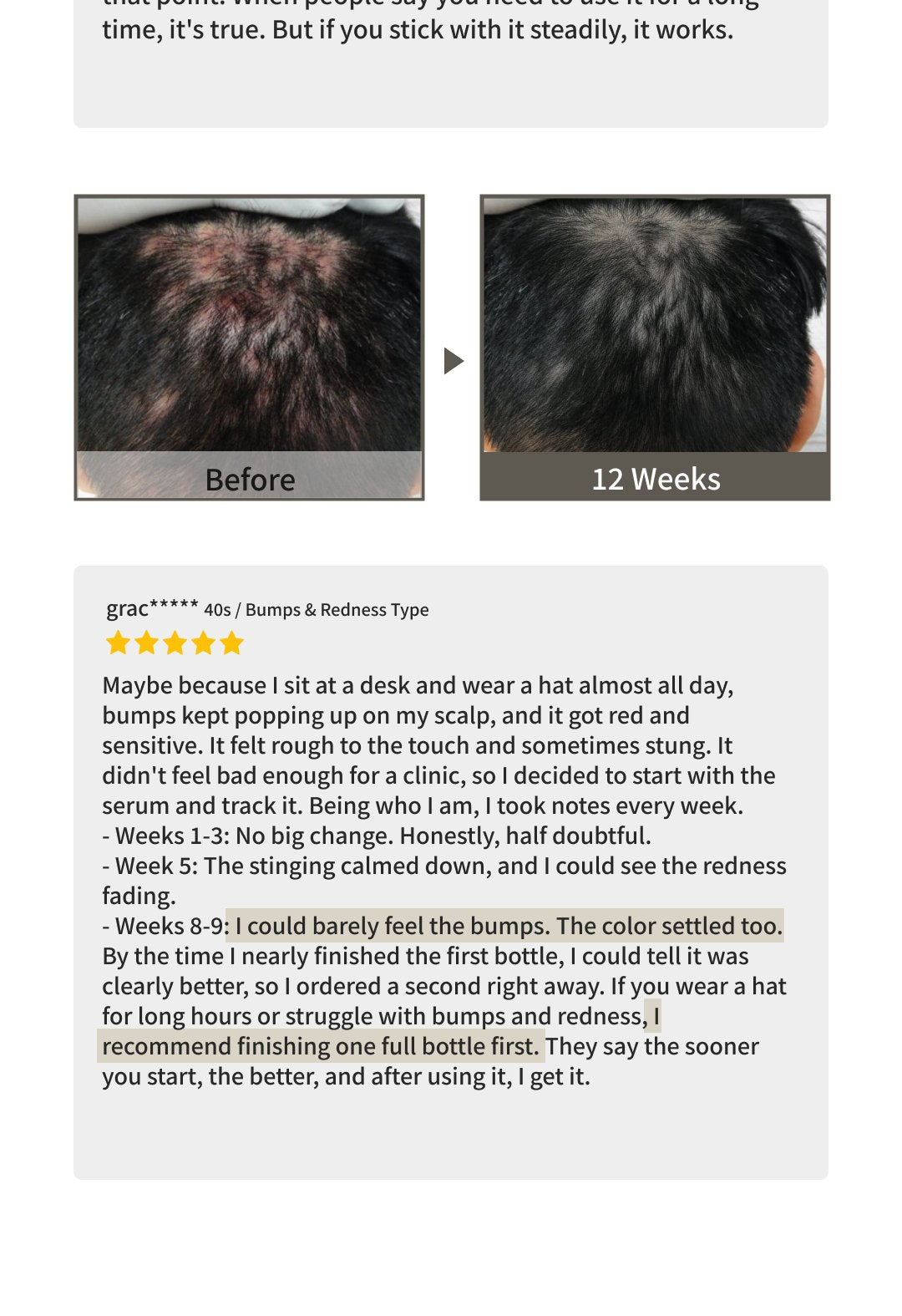 MOGAM Changpo Root Ritual Scalp Serum detail 24