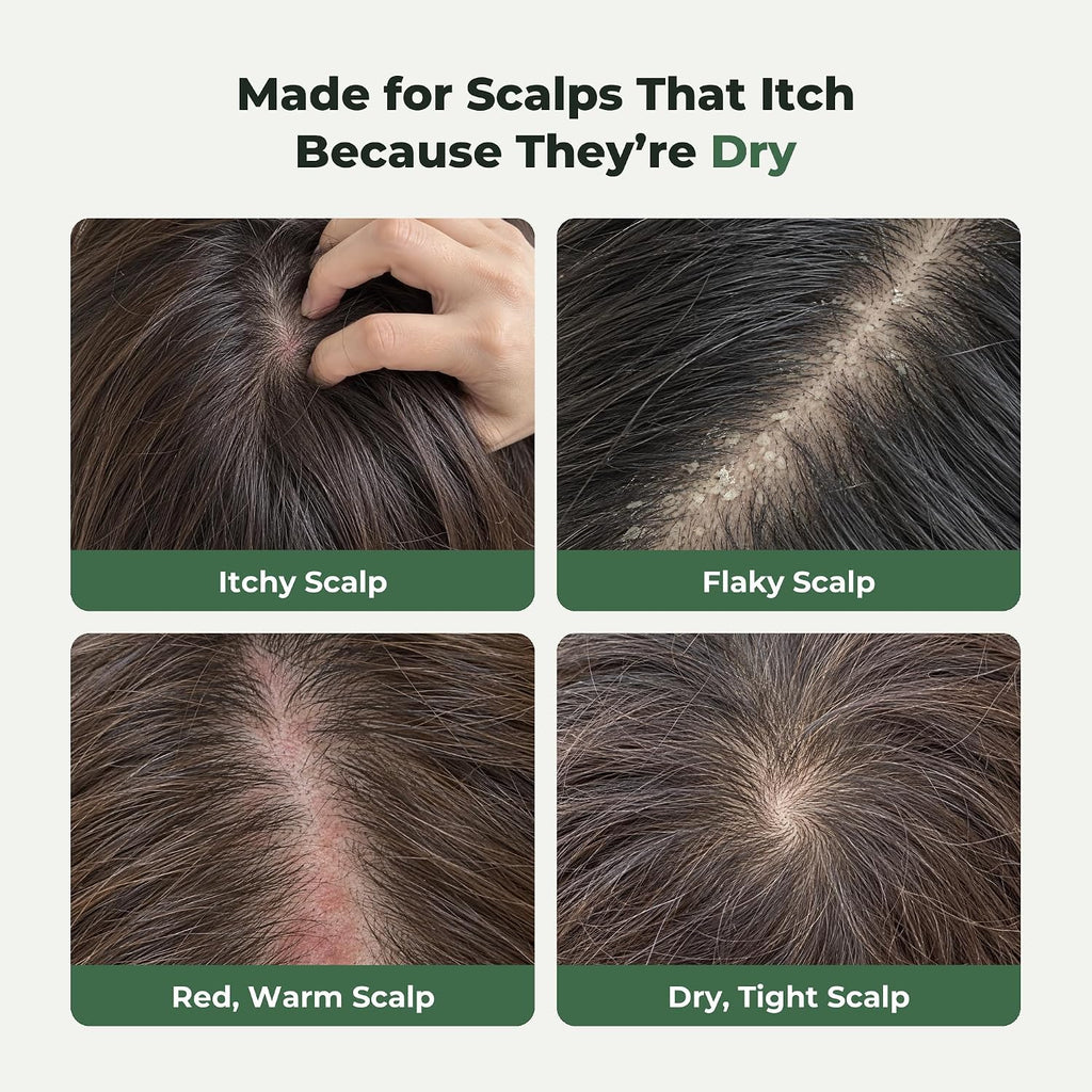 MOGAM - Changpo Root Ritual Scalp Serum