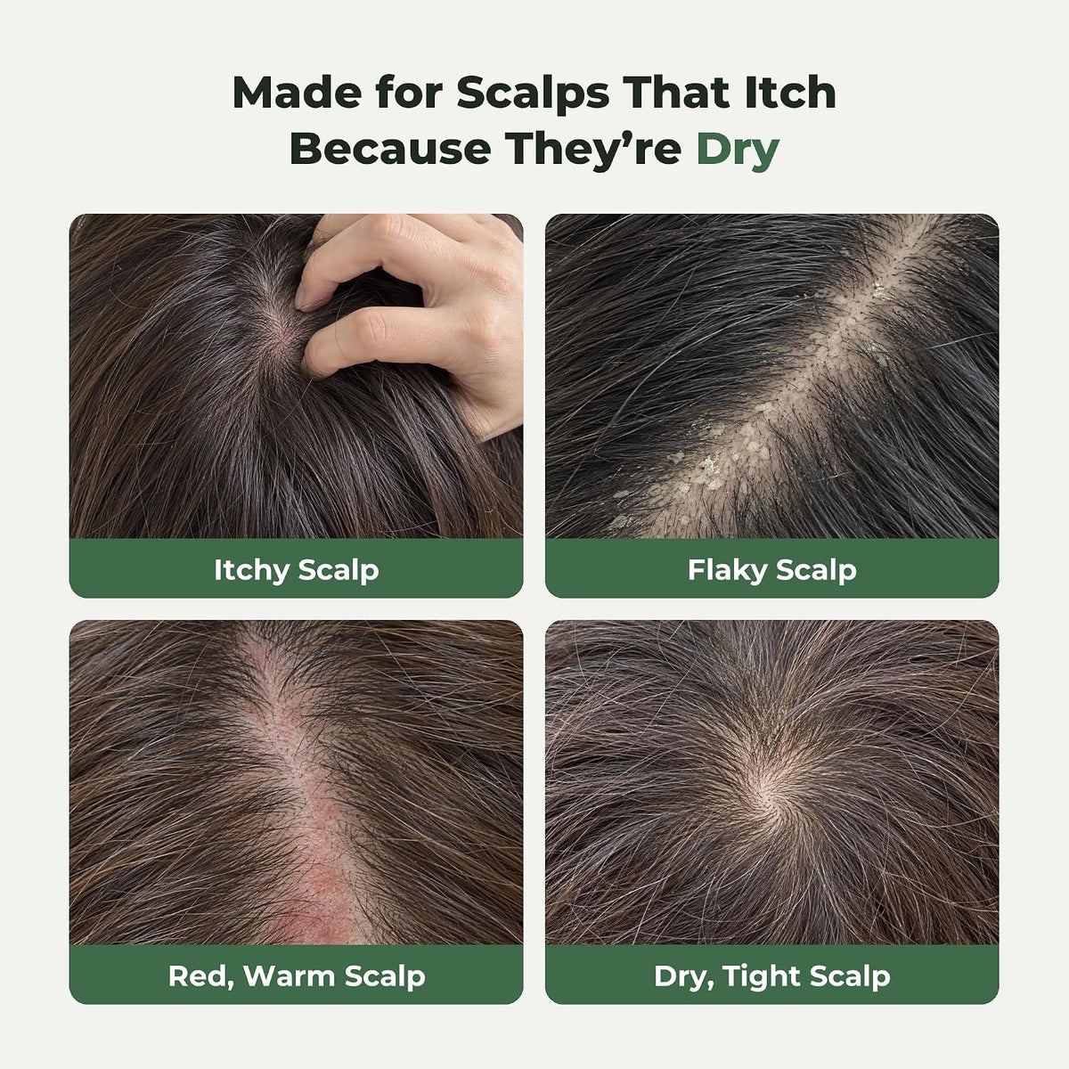 MOGAM - Changpo Root Ritual Scalp Serum